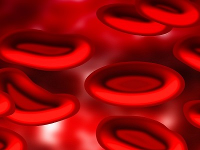 Αναιμία: Πώς εκδηλώνεται και πώς μπορεί να προληφθεί