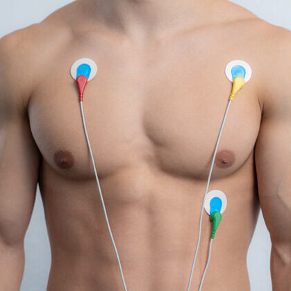 Cardisio-Ablauf-Signalaufnahme